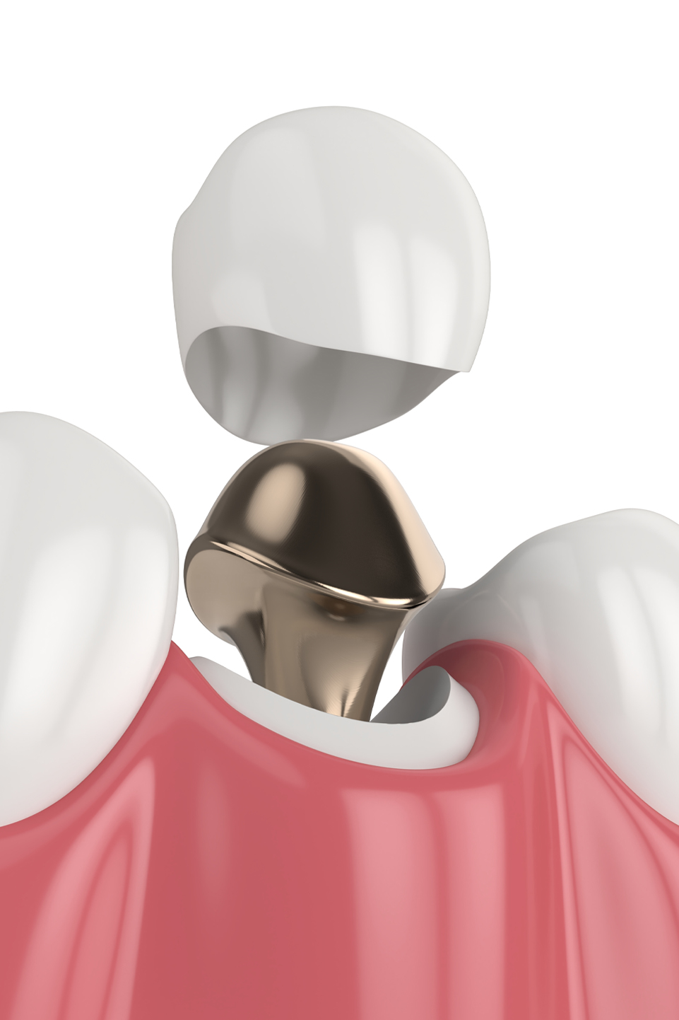 Cliniques-dentaires-montmagny-chaudiere-appalaches-85