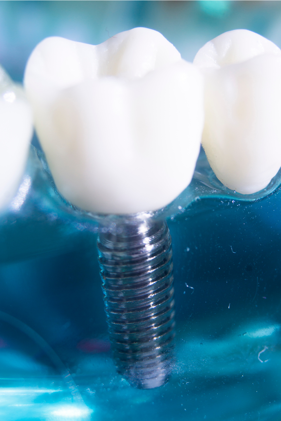 Cliniques-dentaires-montmagny-chaudiere-appalaches-89